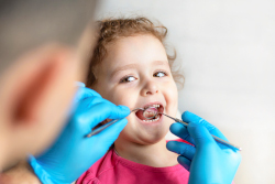orthodontie-les-malocclusions-dentaires-dans-le-sens-horizontal-dentiste-marseille
